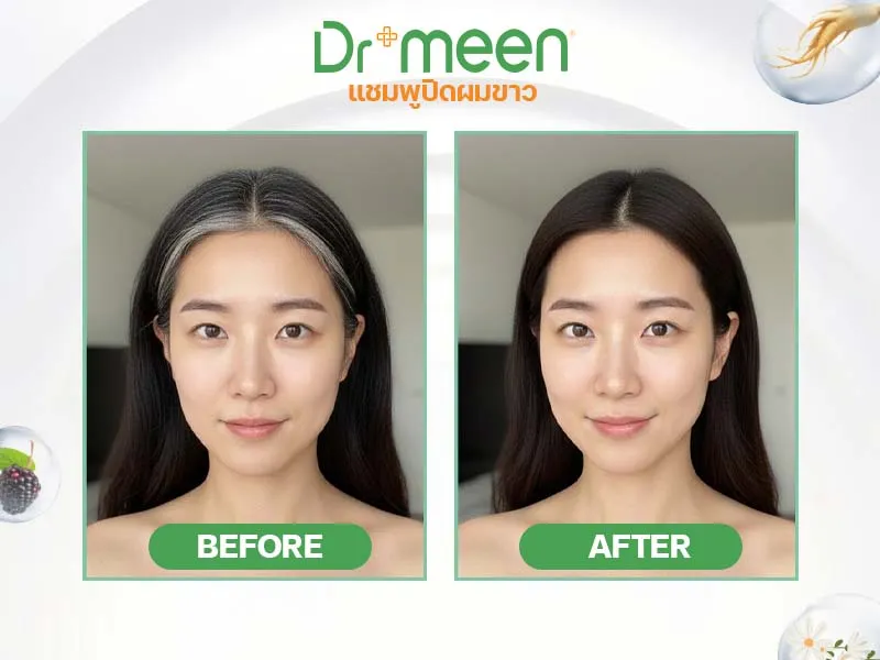 Before & After — แชมพูปิดผมขาว