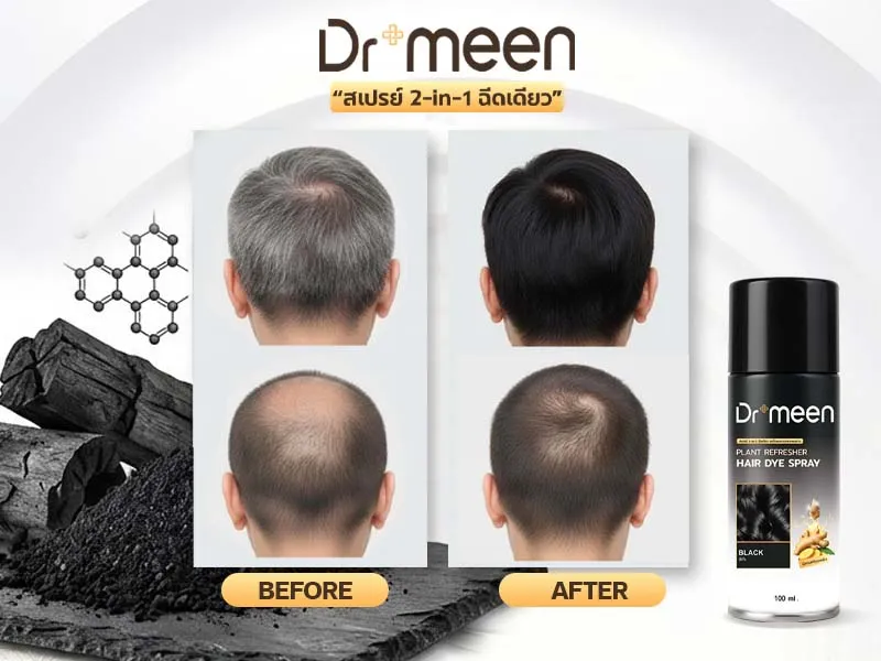 Before & After — สเปรย์ปิดผมขาว