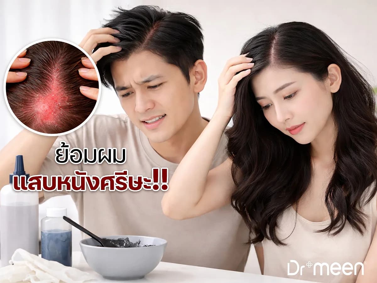 ย้อมผมแล้วแสบหนังศีรษะ